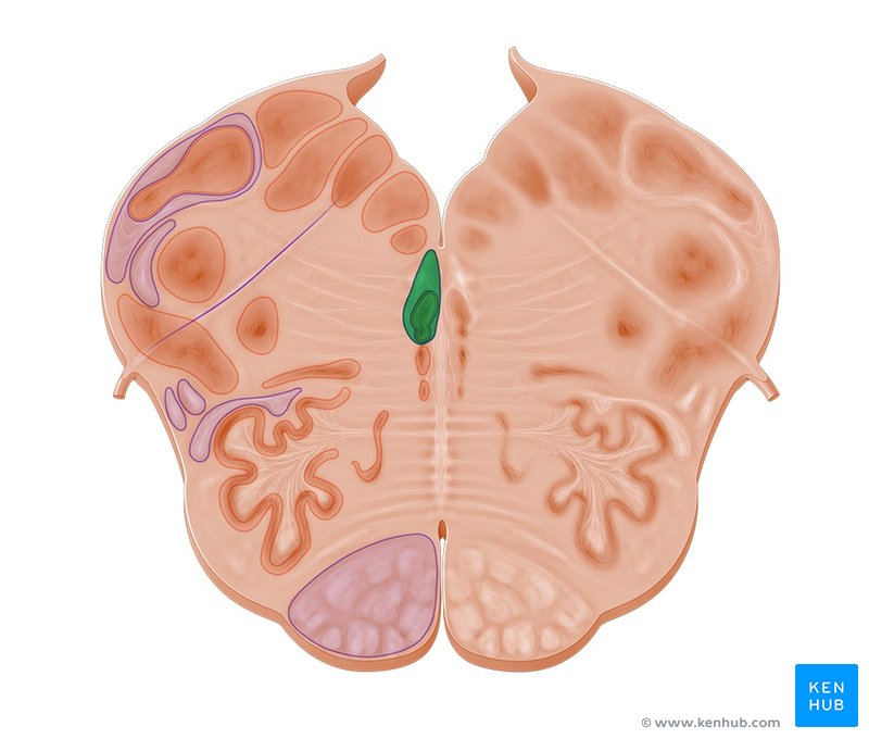 Medial longitudinal fasciculus - axial view