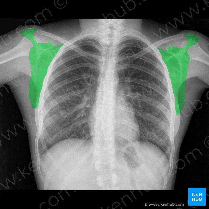 Escápula (Scapula); Imagem: 