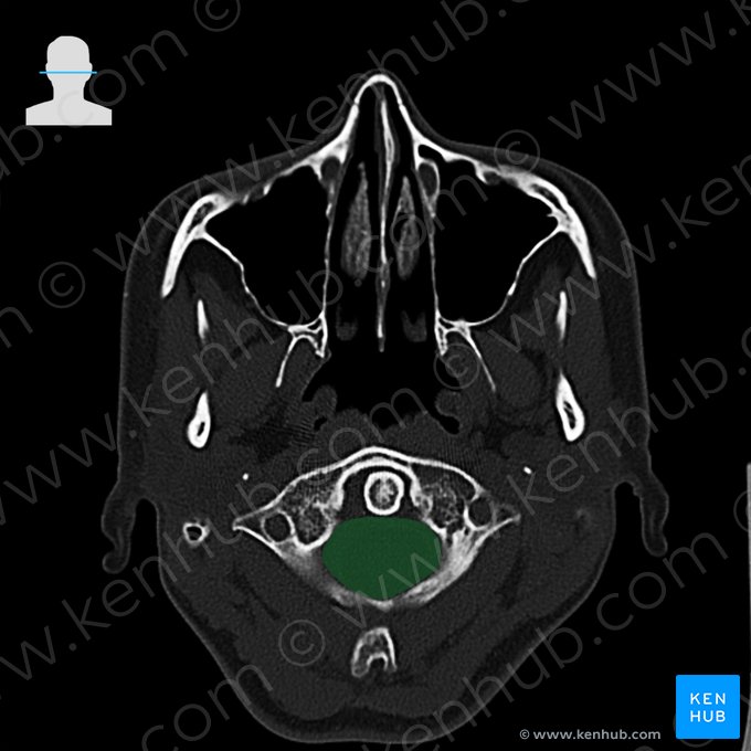 Conducto vertebral (Canalis vertebralis); Imagen: 