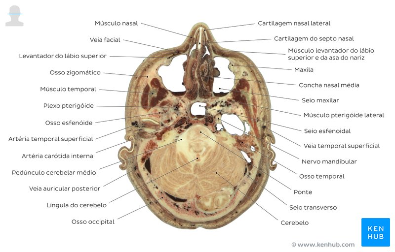 Secção transversal através dos seios maxilares - diagrama