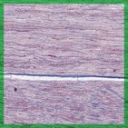Histología del tejido nervioso