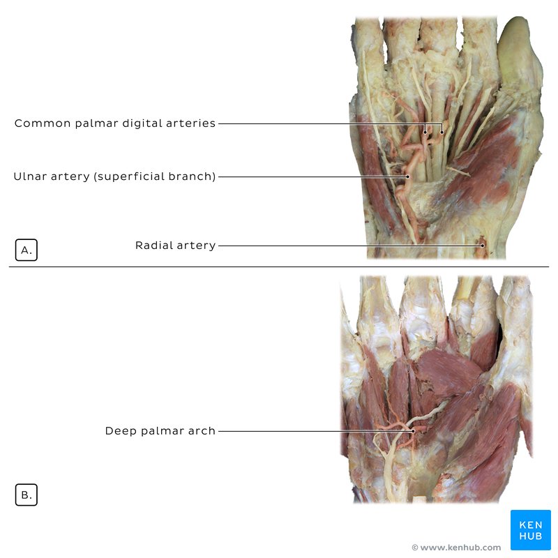 Superficial and deep palmar arches of the hand - anterior view