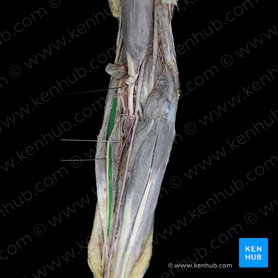 Musculus extensor carpi radialis longus (Langer speichenseitiger Handstrecker); Bild: 
