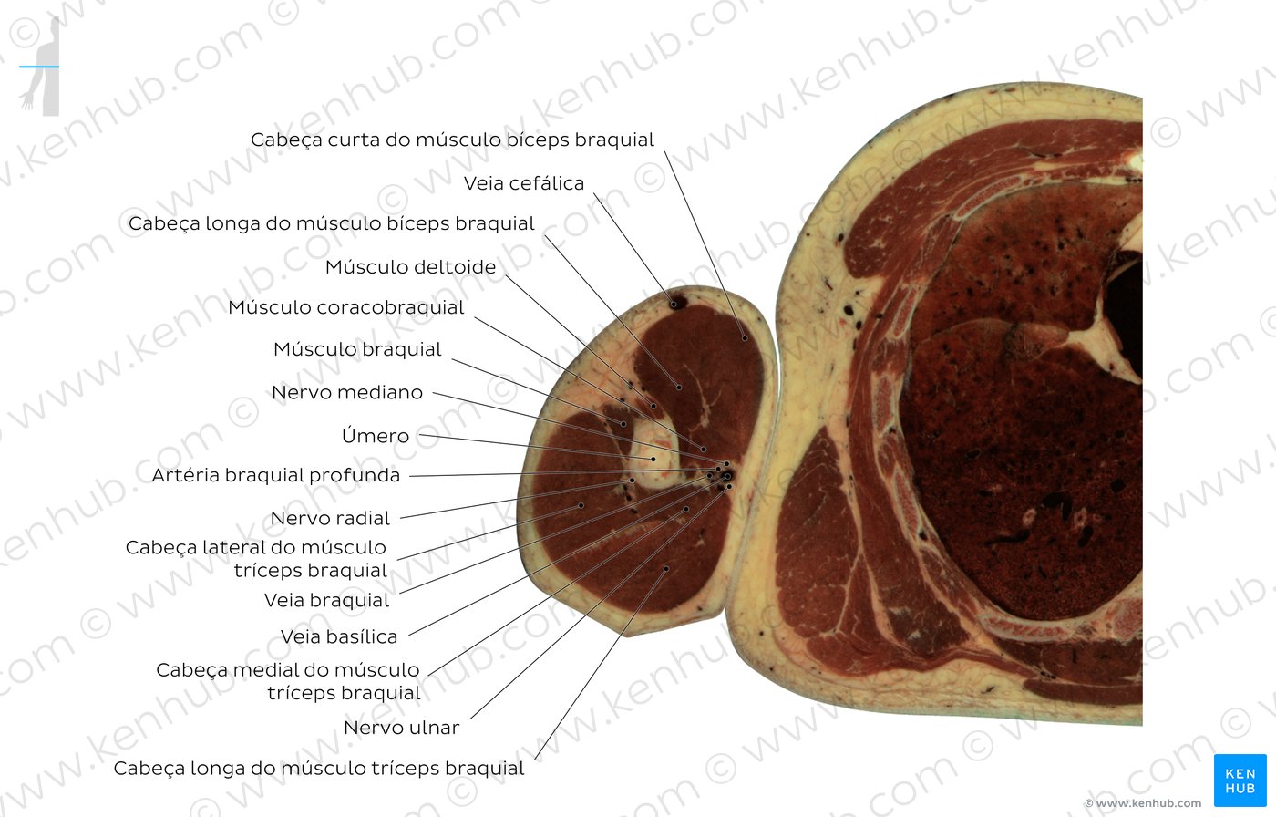 Corte transversal através do músculo bíceps braquial - Diagrama