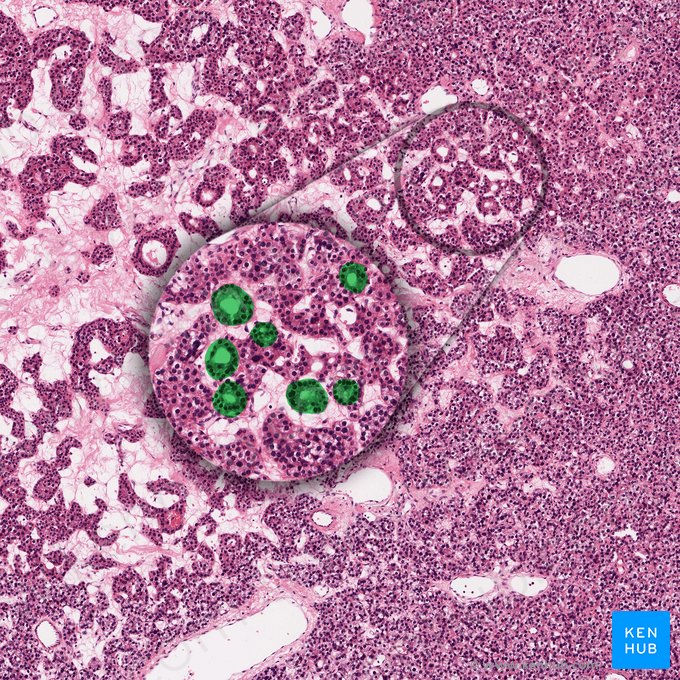 Disposición acinar de las células principales (Acinus parathyroideus); Imagen: 