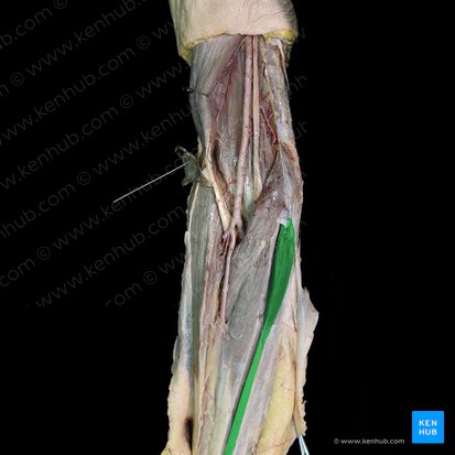 Musculus palmaris longus (Langer Hohlhandmuskel); Bild: 