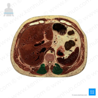 Musculus longissimus thoracis (Brustteil des langen Rückenmuskels); Bild: National Library of Medicine