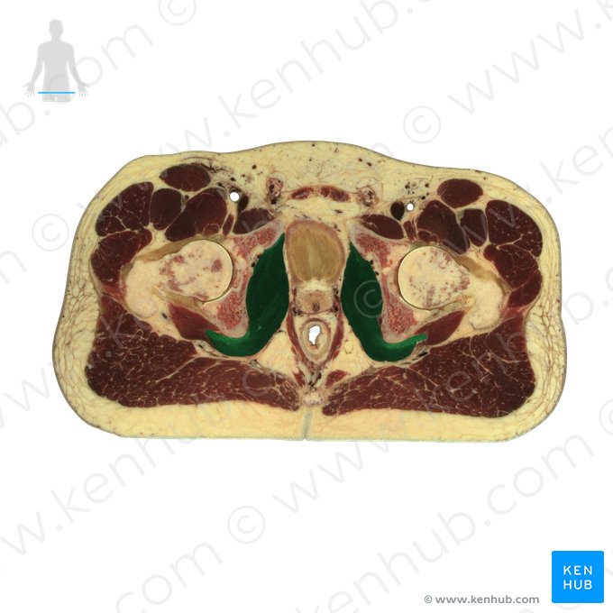 Musculus obturatorius internus (Innerer Hüftlochmuskel); Bild: National Library of Medicine