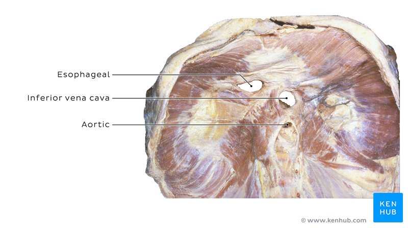 Abdominal surface of the diaphragm in a cadaver