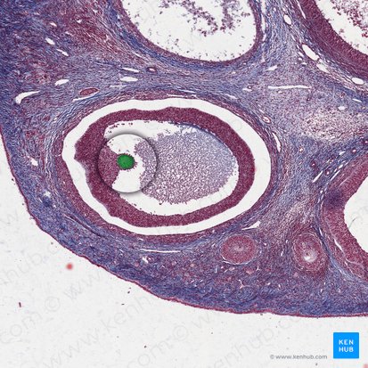 Secondary oocyte; Image: 