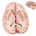 Choroid plexus