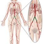 Arteria iliaca communis