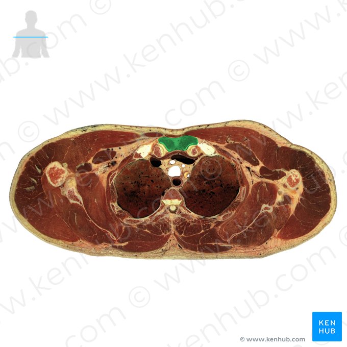 Manubrium of sternum (Manubrium sterni); Image: National Library of Medicine