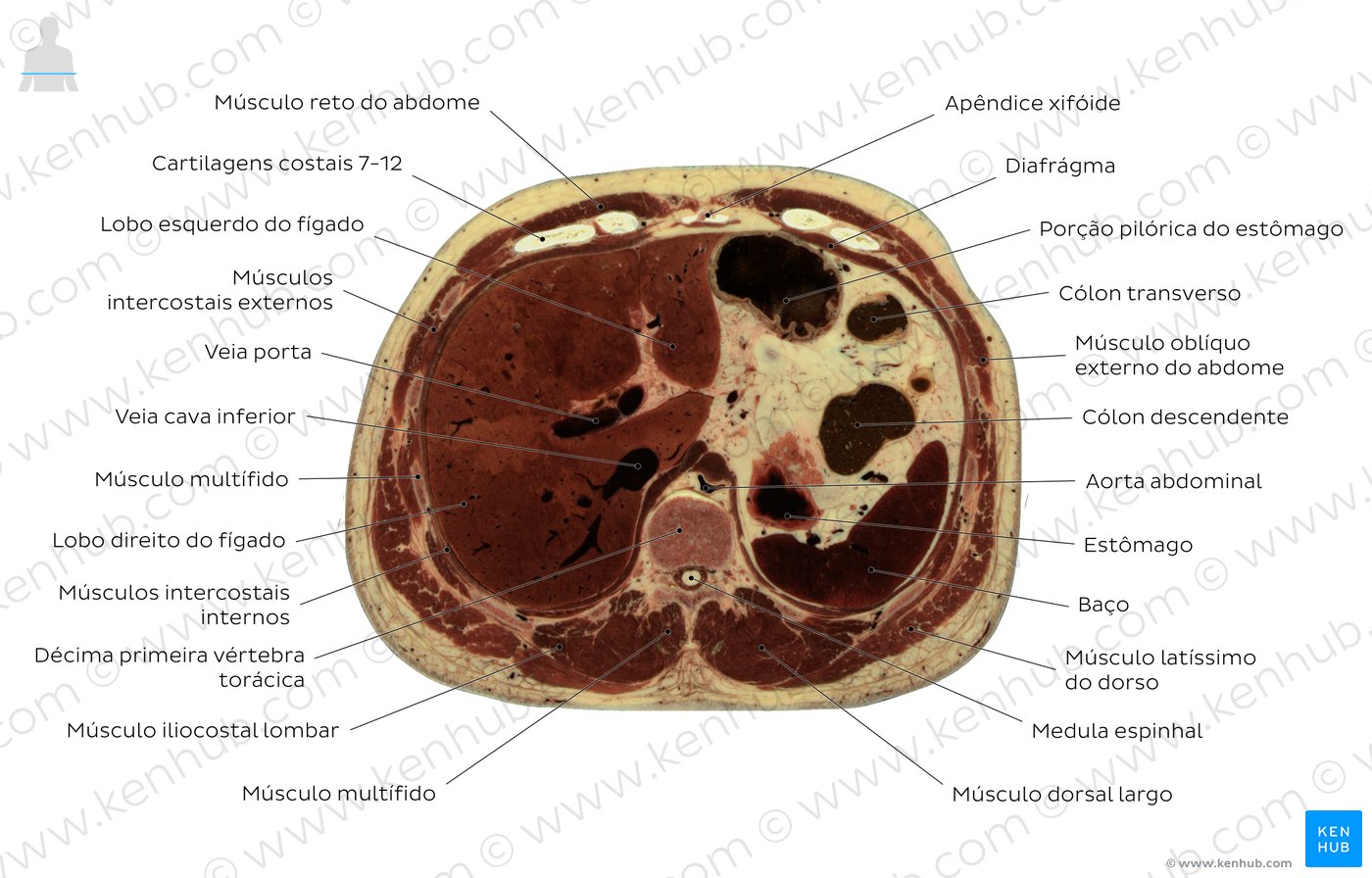 Corte transversal do abdômen passando por T11 - Diagrama