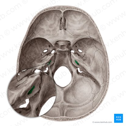 Conducto auditivo interno (Meatus acusticus internus); Imagen: Yousun Koh