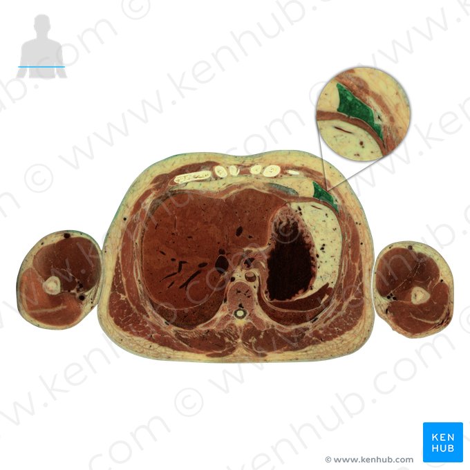 Lobus superior pulmonis sinistri (Oberlappen der linken Lunge); Bild: National Library of Medicine