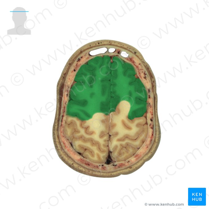 Lobo frontal (Lobus frontalis); Imagem: National Library of Medicine