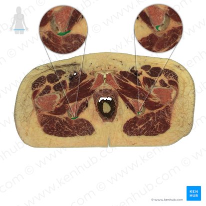 Ligamentum sacrotuberale (Kreuzbein-Sitzbeinhöcker-Band); Bild: National Library of Medicine