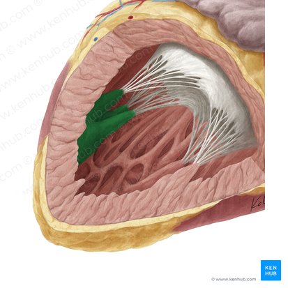 Músculo papilar anterior del ventrículo izquierdo (Musculus papillaris superior ventriculi sinistri); Imagen: Yousun Koh