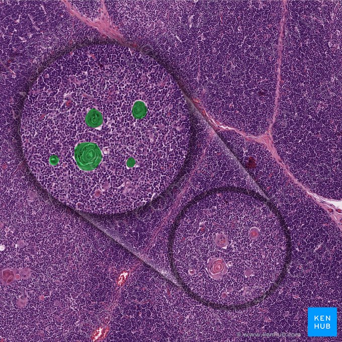 Thymic corpuscle (Cospusculum thymicum); Image: 