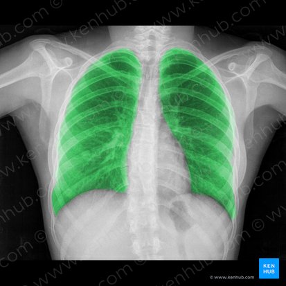 Lung (Pulmo); Image: 