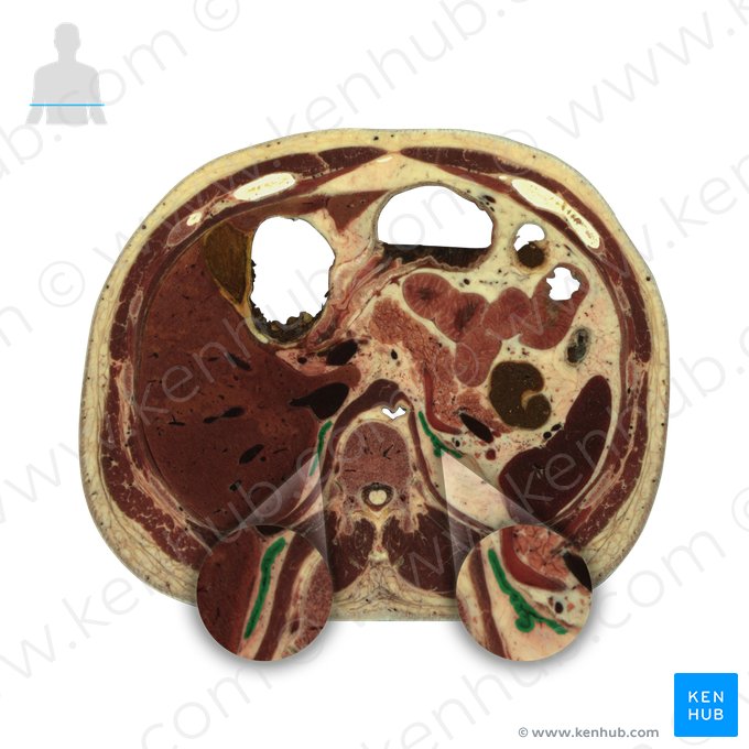 Suprarenal gland (Glandula suprarenalis); Image: National Library of Medicine