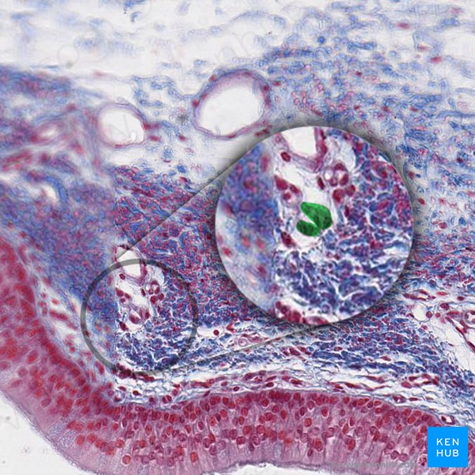 Histiocyte (Histiocytus); Image: 