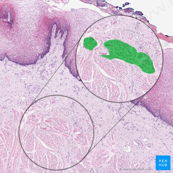 Músculo longitudinal superior da língua (Musculus longitudinalis superior linguae); Imagem: 