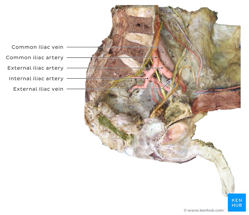 Common iliac vessels inside a cadaver