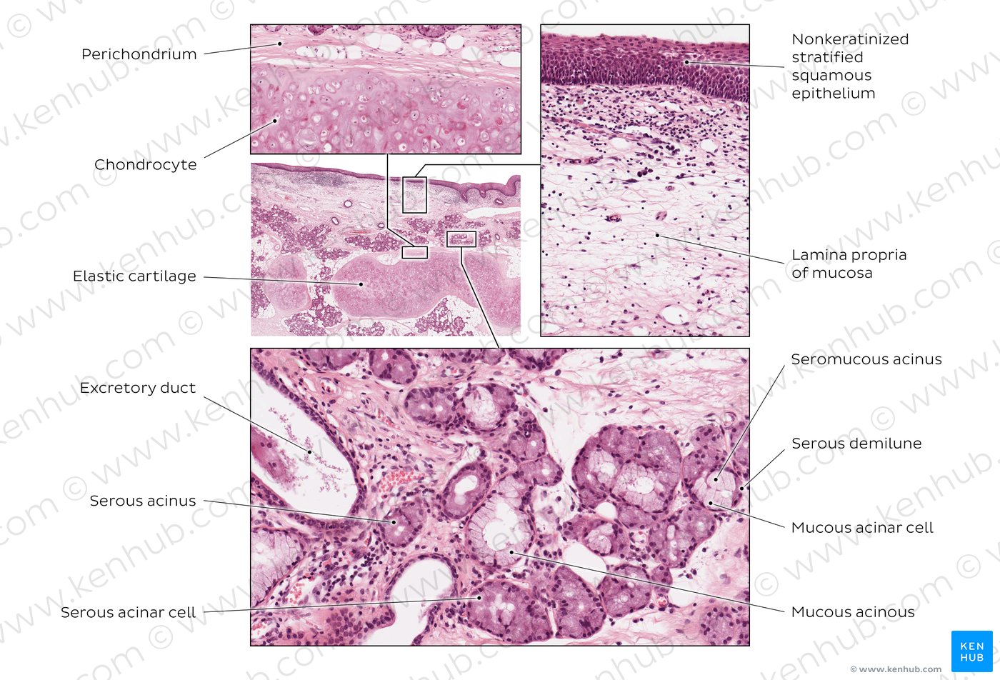 Epiglottis. Stain: H&E. Medium-to-high magnification.
