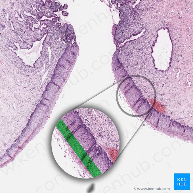 Intermediate cell layer of squamous epithelium; Image: 