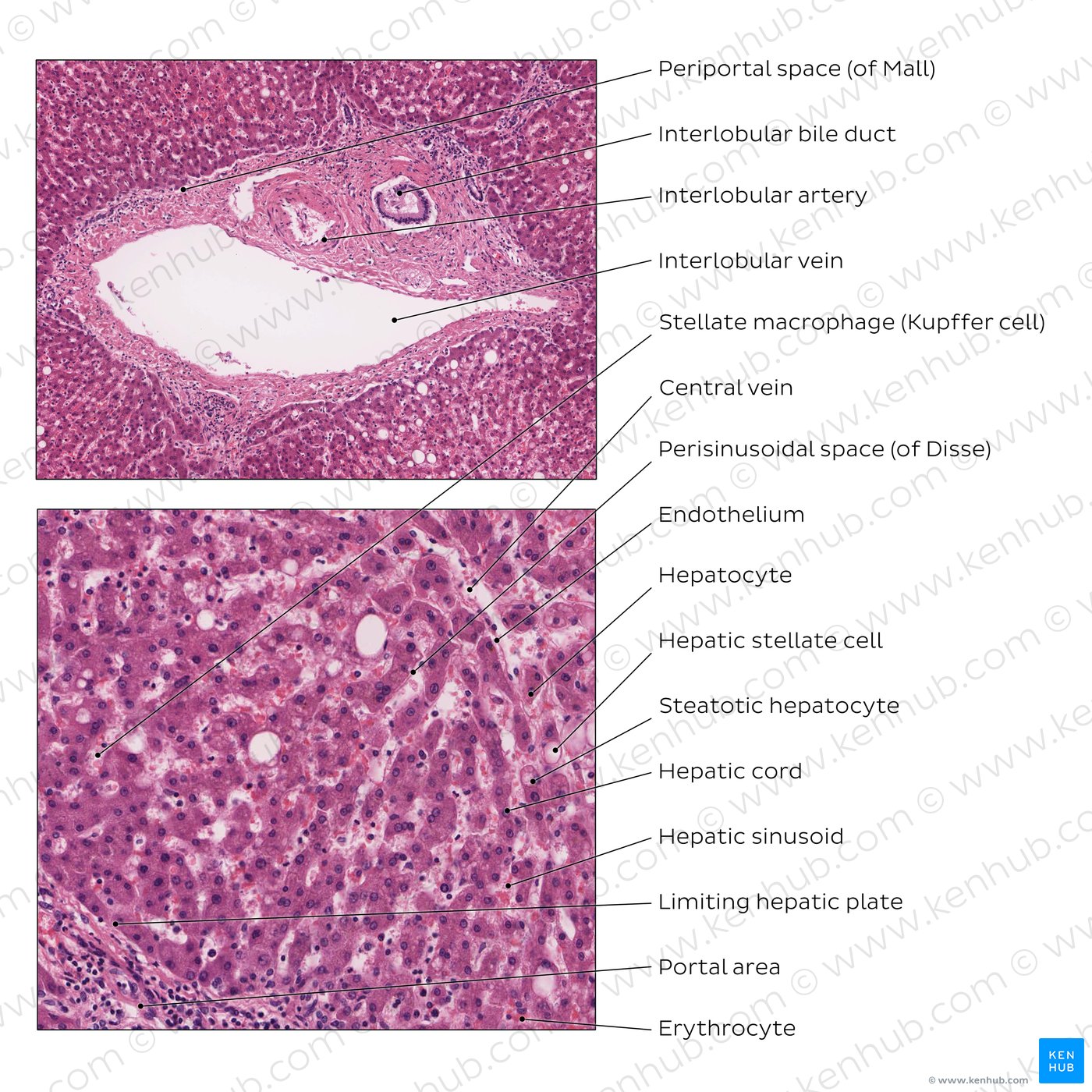 Liver (high magnification)