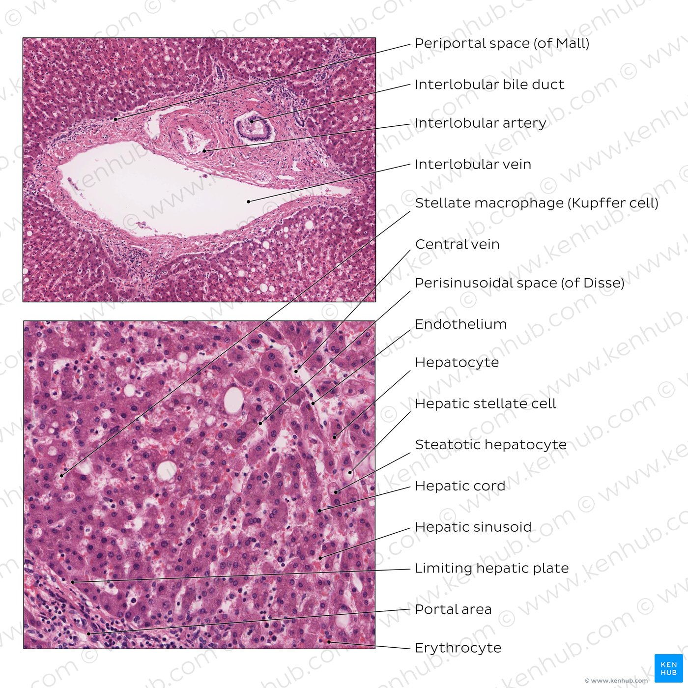 Liver (high magnification)