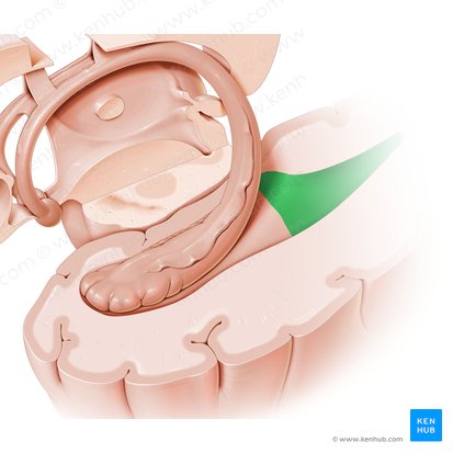 Asta occipital del ventrículo lateral (Cornu occipitale ventriculi lateralis); Imagen: Paul Kim