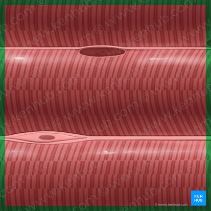 Músculo esquelético (Textus muscularis skeletalis); Imagen: Tal Bavli Ziv