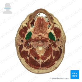 Musculus pterygoideus medialis (Innerer Flügelmuskel); Bild: National Library of Medicine