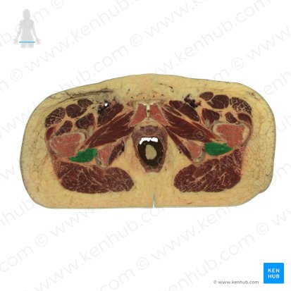 Músculo quadrado femoral (Musculus quadratus femoris); Imagem: National Library of Medicine