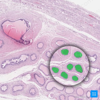 Dúctulos eferentes do testículo (Ductuli efferentes testis); Imagem: 