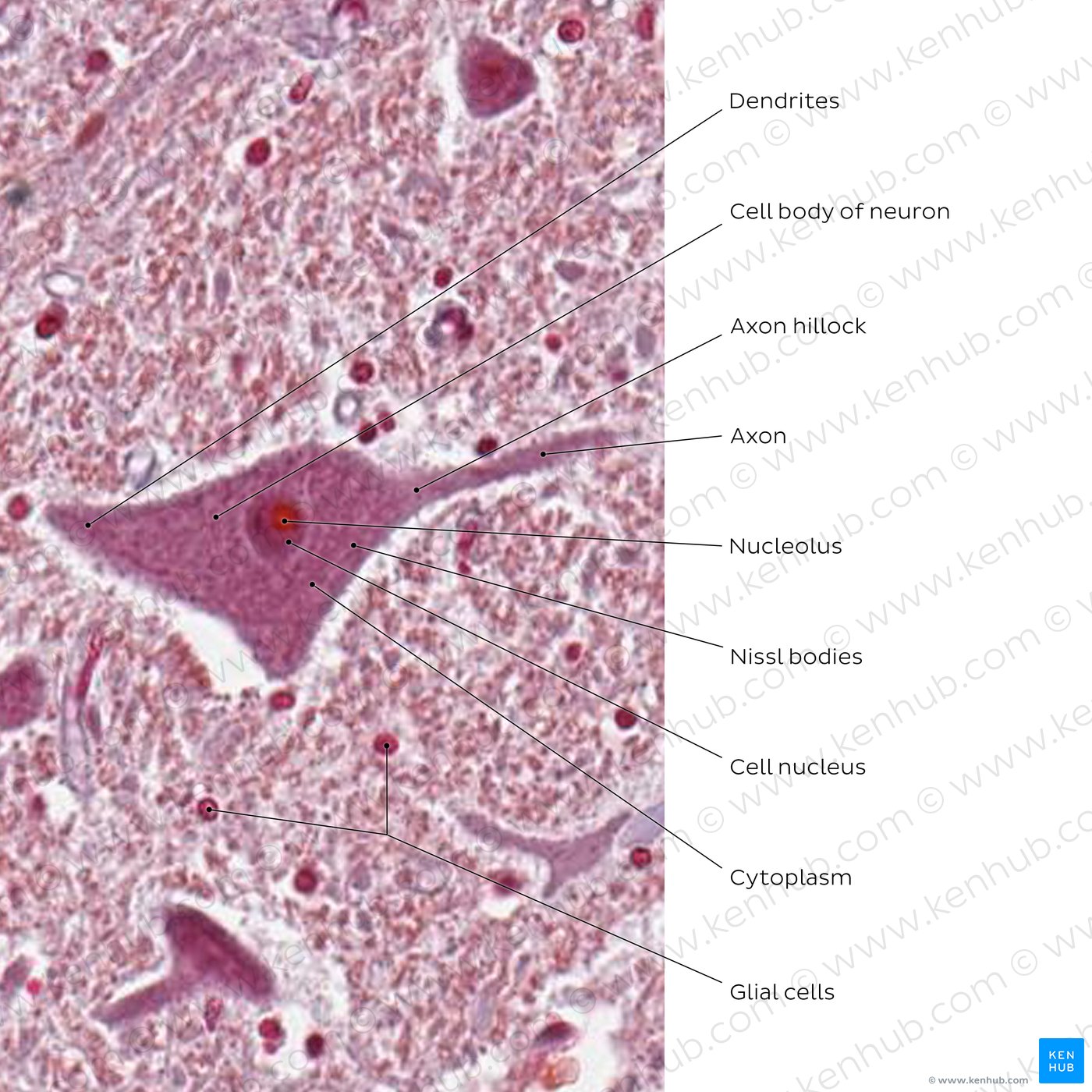 Multipolar neuron