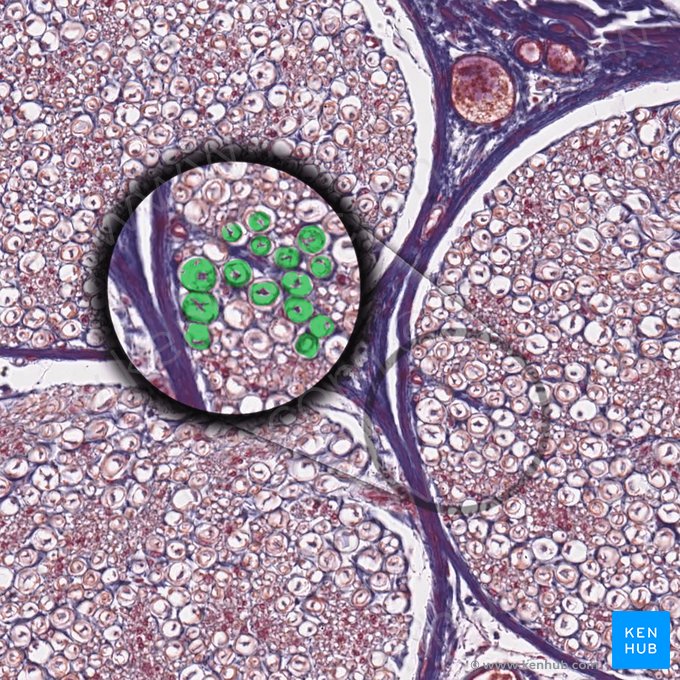 Spatium myelini (Heller Hof (ausgewaschenes Myelin)); Bild: 