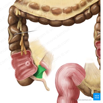 Mesoappendix (Wurmfortsatzgekröse); Bild: Begoña Rodriguez