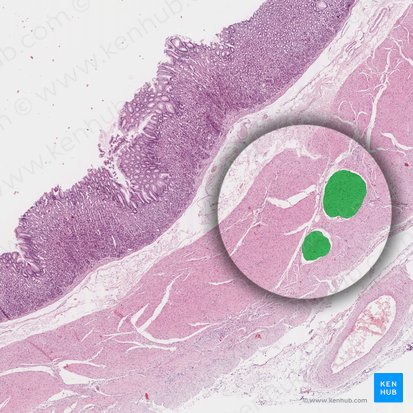 Capa muscular circular del estómago (Stratum circulare tunicae muscularis gastris); Imagen: 