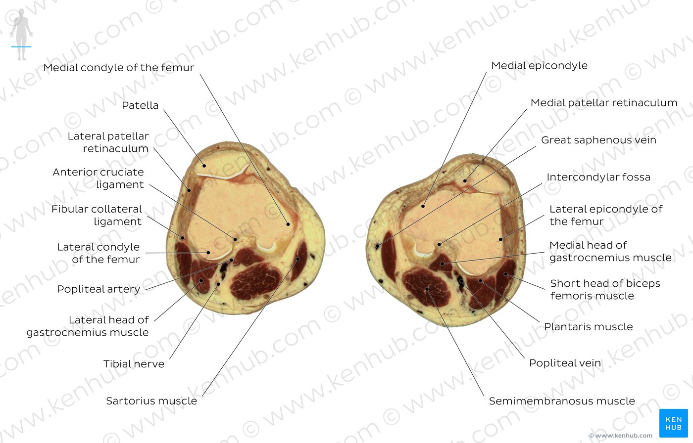 Patella level: Overview