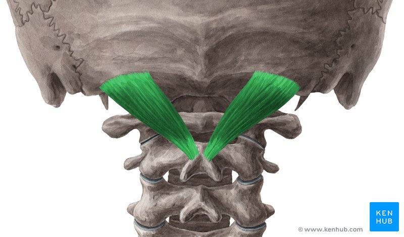 Rectus capitis posterior major muscle (musculus rectus capitis posterior major)