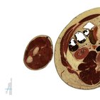 Cross sections of the upper extremity: Forearm level