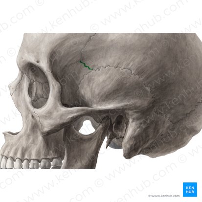 Sphenoparietal suture (Sutura sphenoparietalis); Image: Yousun Koh