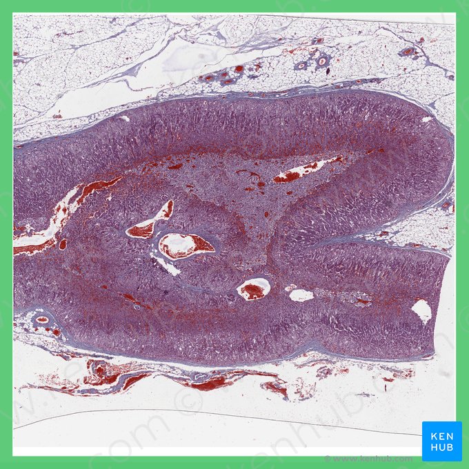 Glândula suprarrenal (Glandula suprarenalis); Imagem: 