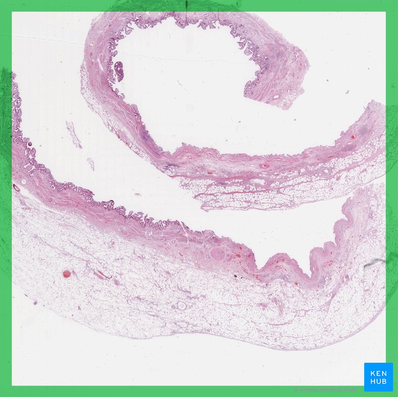 Gallbladder - histological slide