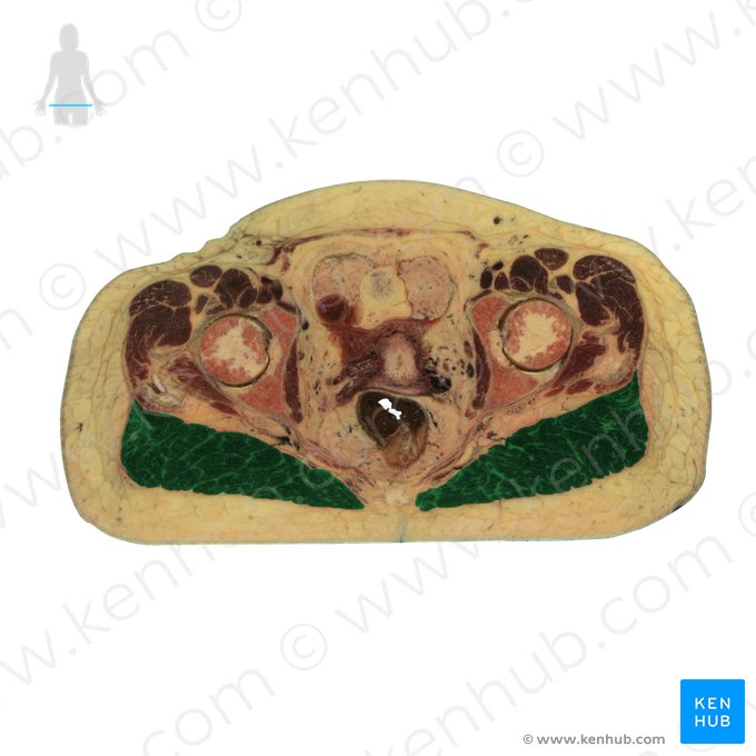 Gluteus maximus muscle (Musculus gluteus maximus); Image: National Library of Medicine