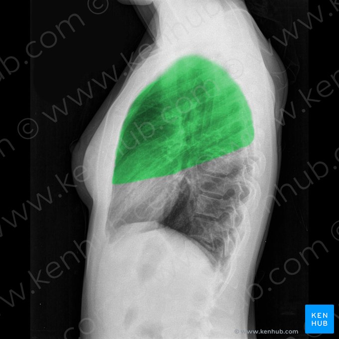 Lóbulo superior del pulmón derecho (Lobus superior pulmonis dextri); Imagen: 